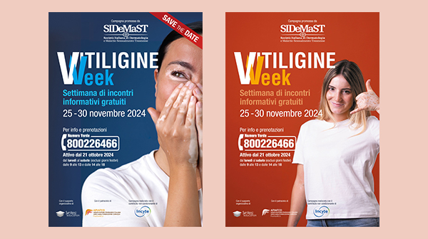 Vitiligine Week 25-30 novembre: ultimi posti per un incontro gratuito con i dermatologi